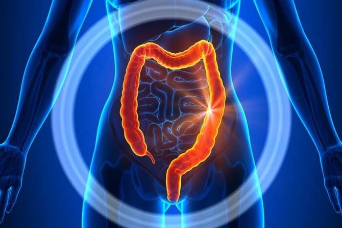 شكل البراز في القولون العصبي