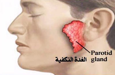 اعراض و علاج مرض الغدة النكافية اعراض و علاج مرض الغدة النكافية