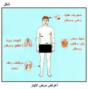 اعراض وعلاج الايدز اعراض وعلاج الايدز