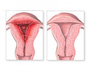 اسباب وعلاج حمى النفاس اسباب وعلاج حمى النفاس
