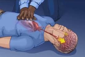 التنفس الاصطناعي