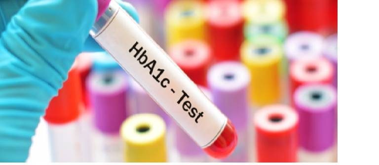 كيف تنزل السكر التراكمي ؟.. حمية + رياضة