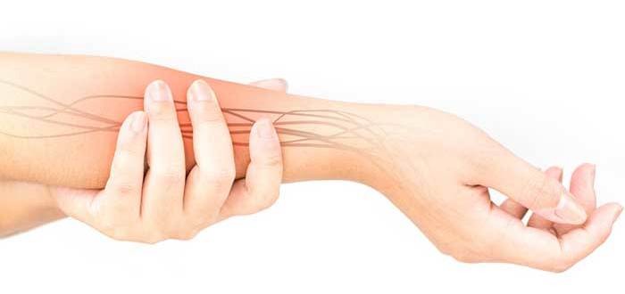 لماذا يحدث اختناق عصب اليد