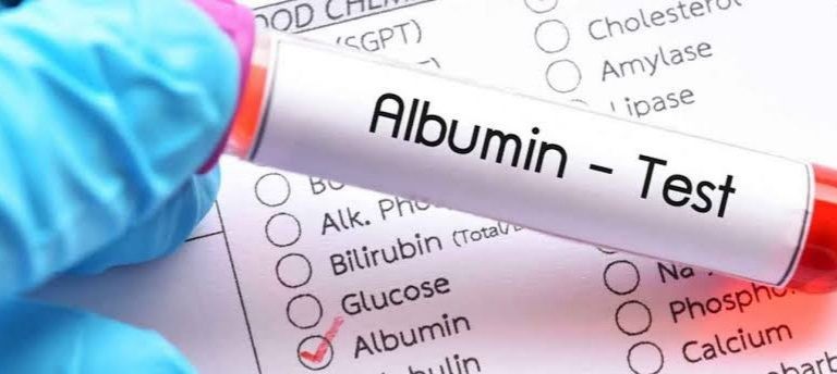 نسبة البروتين الطبيعية في البول