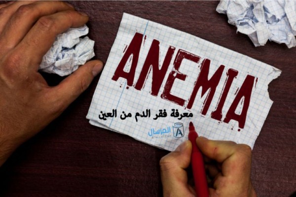 كيف اعرف فقر الدم من العين كيف اعرف فقر الدم من العين