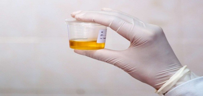 كمية البول الطبيعية في 24 ساعة