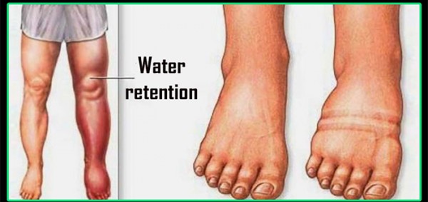 كيف ازيل الماء الزائد من الجسم