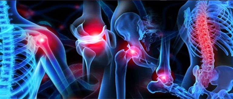 الفرق بين ألم العضلات وألم العظام