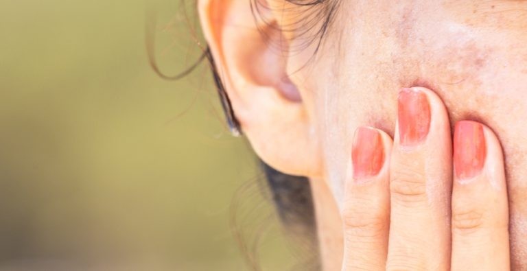 اسباب زيادة صبغة الميلانين وعلاجها