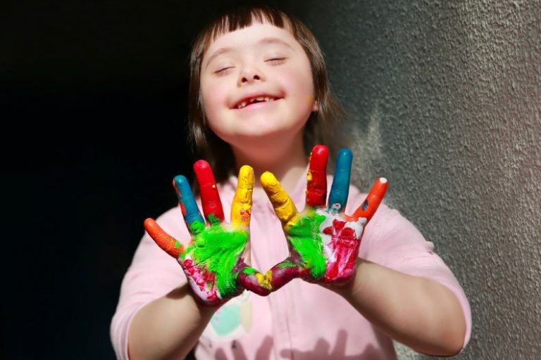 أعراض متلازمة داون الشائعة  