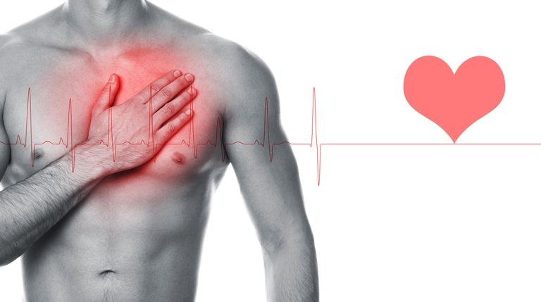 اسباب السكتة القلبية المفاجئة عند الشباب