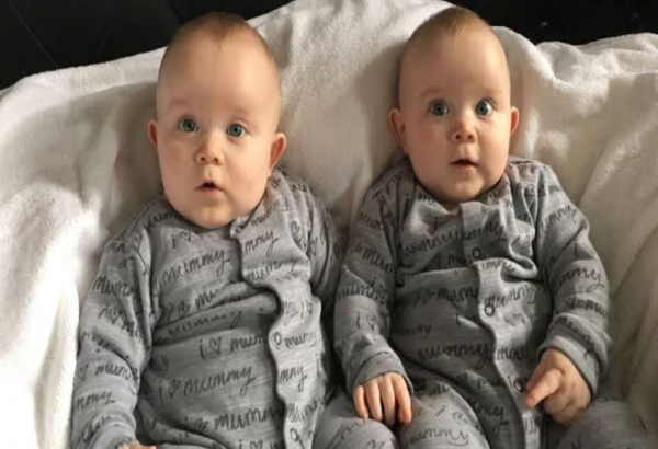 صور أنواع التوائم