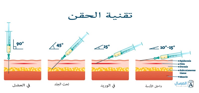 الفرق بين إبرة العضل وابرة تحت الجلد الفرق بين إبرة العضل وابرة تحت الجلد