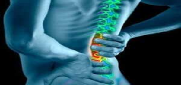 علاج عرق النسا بالكي