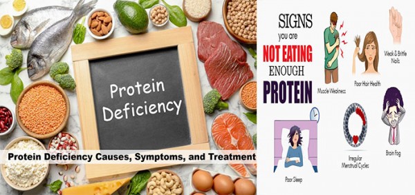 كيف اعوض نقص البروتين