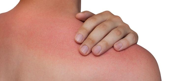 متى تكون الحكة خطيرة