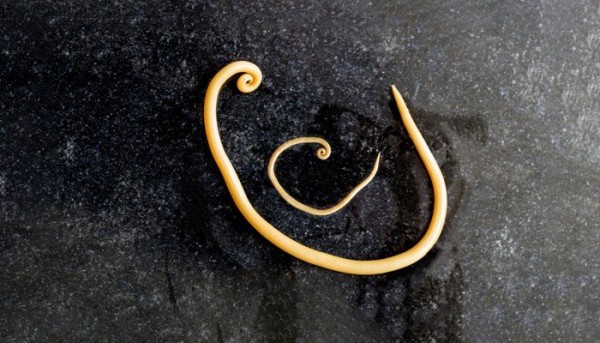 معلومات عن الديدان الخيطية معلومات عن الديدان الخيطية