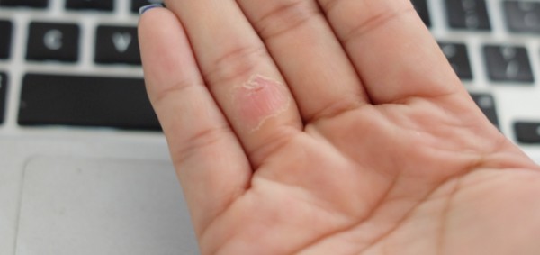 امراض المناعة الذاتية الجلدية