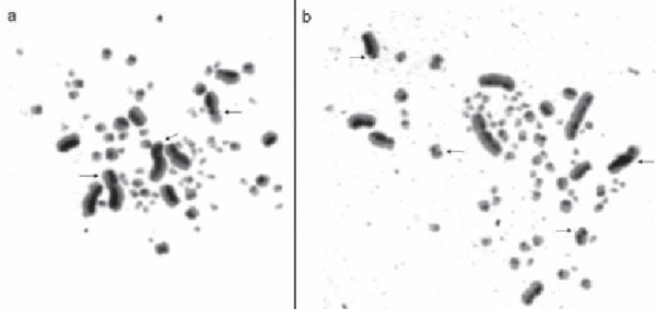 معلومات عن تحليل الكروموسومات