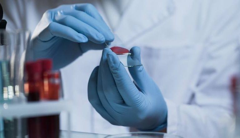 ما هو فحص الاجسام المضادة والمناعية ما هو فحص الاجسام المضادة والمناعية