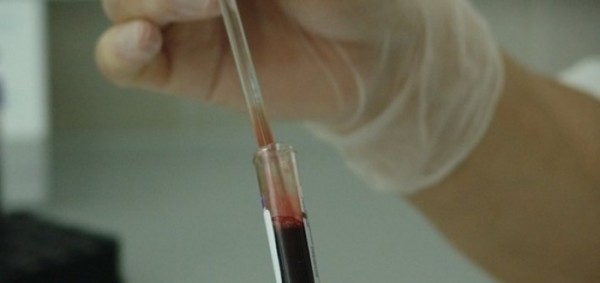 ما هو المصل النقاهي