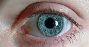 الممنوعات بعد زراعة القرنية