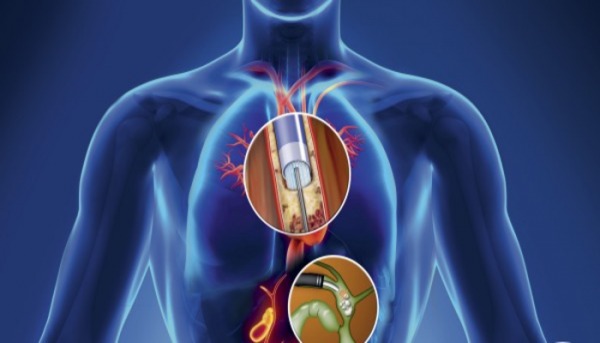 استخدامات الالياف الضوئية في الطب