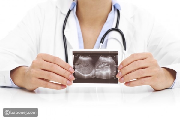 أسباب وعلاج دوالي الرحم