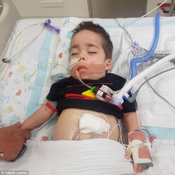 مرض نيمان بيك .. أنواعه وأعراضه والتشخيص والعلاج