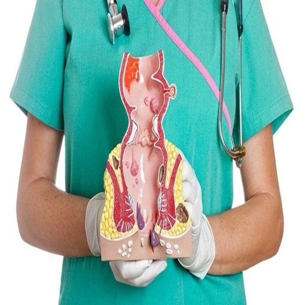 علاج البواسير بالاعشاب