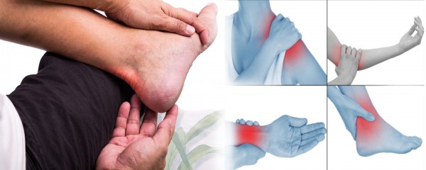 أماكن حدوث الالتهاب أماكن حدوث الالتهاب