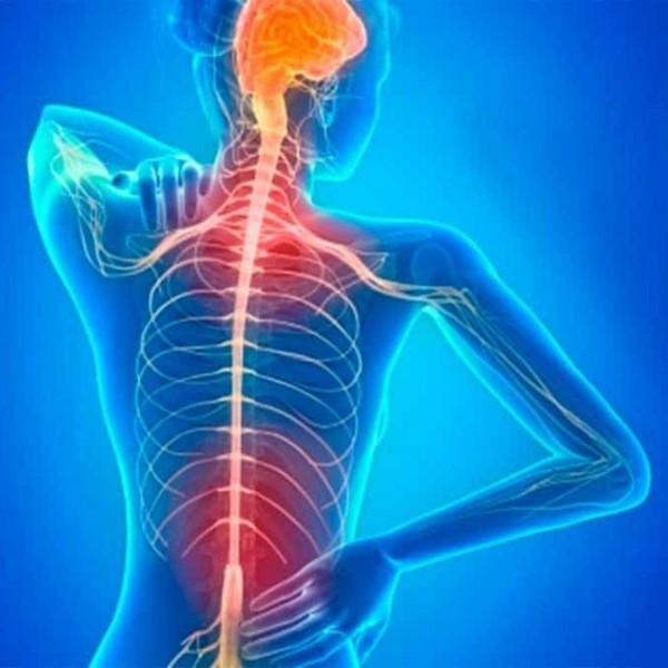 التهاب الاعصاب