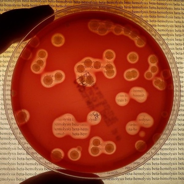 ما هو انحلال الدم