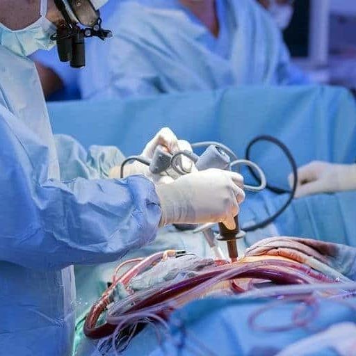 عملية القلب المفتوح