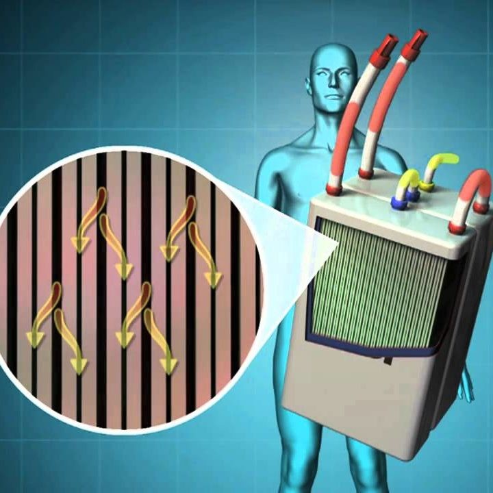 ما هي الكلى الصناعية