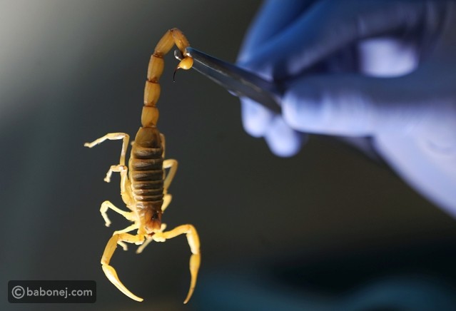 علاج قرصة العقرب طبيعياً وفي المنزل وفي المستشفى