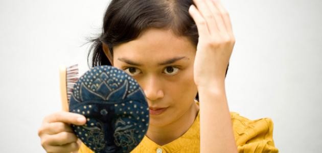 علاج تساقط الشعر الوراثي