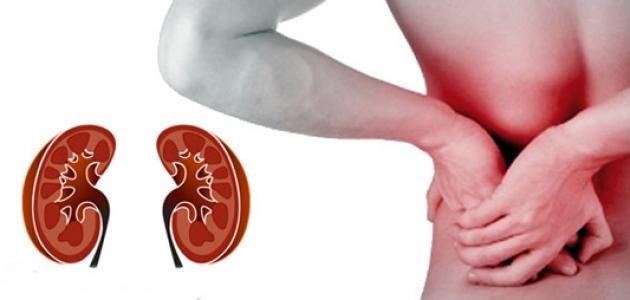 تشخيص الفشل الكلوي