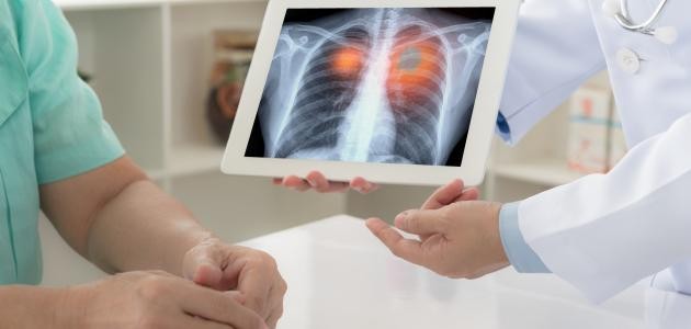 تشخيص مرض الربو