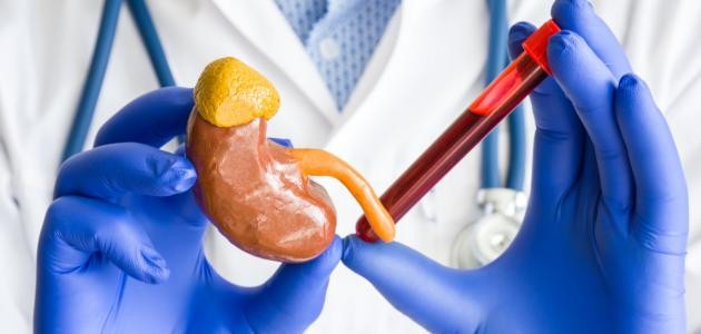 تشخيص مرض أديسون