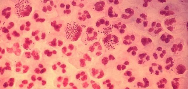 المرحلة الثالثة من مرض الزهري