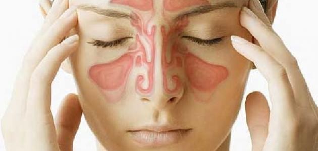 ما هي أعراض الجيوب الأنفية