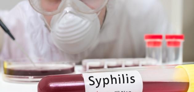 شخصيات بارزة اصيبت بالزهري