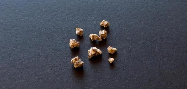 ما هي أعراض حصوات المرارة