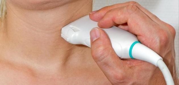 علاج تضخم الغدة الدرقية