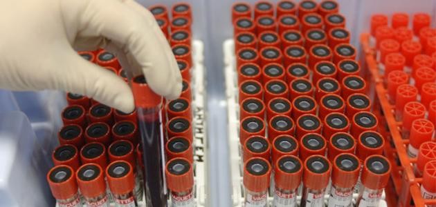 ما هي خصائص فصيلة الدم O-