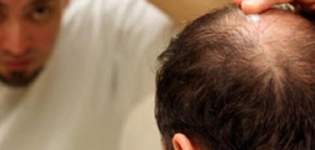 كيفية تنشيط بصيلات الشعر