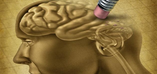 ما هي أعراض ضمور الدماغ