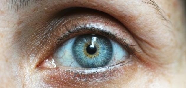 ما هو سبب وجع العين