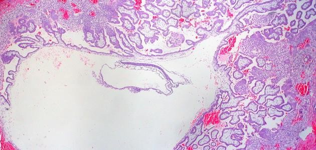 ما هو معدل هرمون الحمل